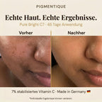 Pigmentique Pure Bright C7 Serum (V2)