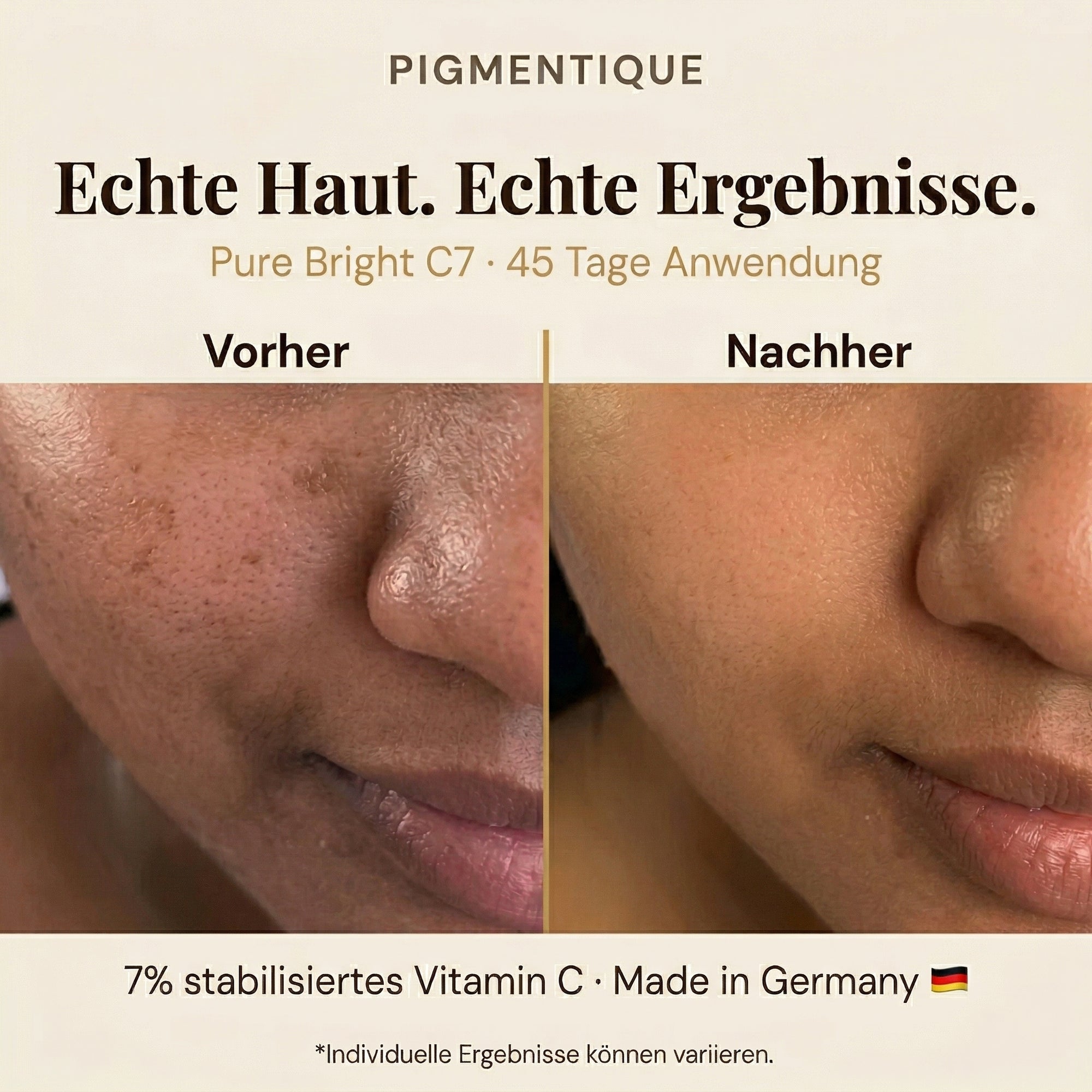 Pigmentique Pure Bright C7 Serum (V2)