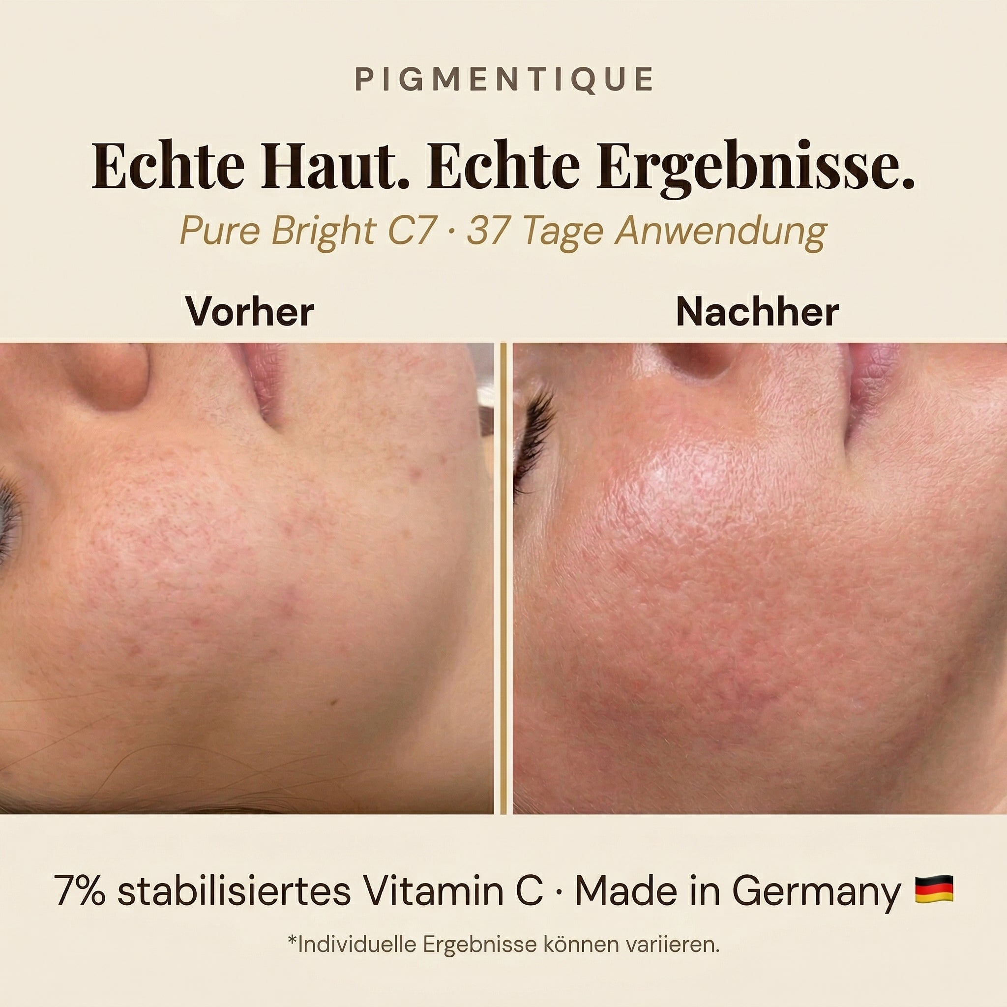 Pigmentique Pure Bright C7 Serum (V2)