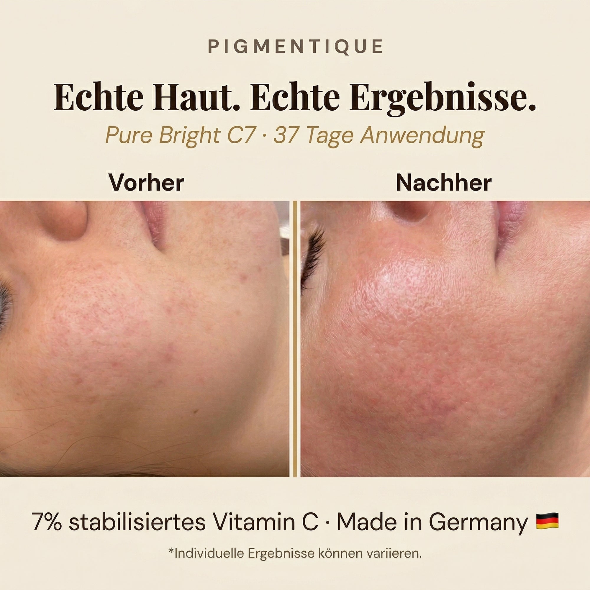 Pigmentique Pure Bright C7 Serum (V2)
